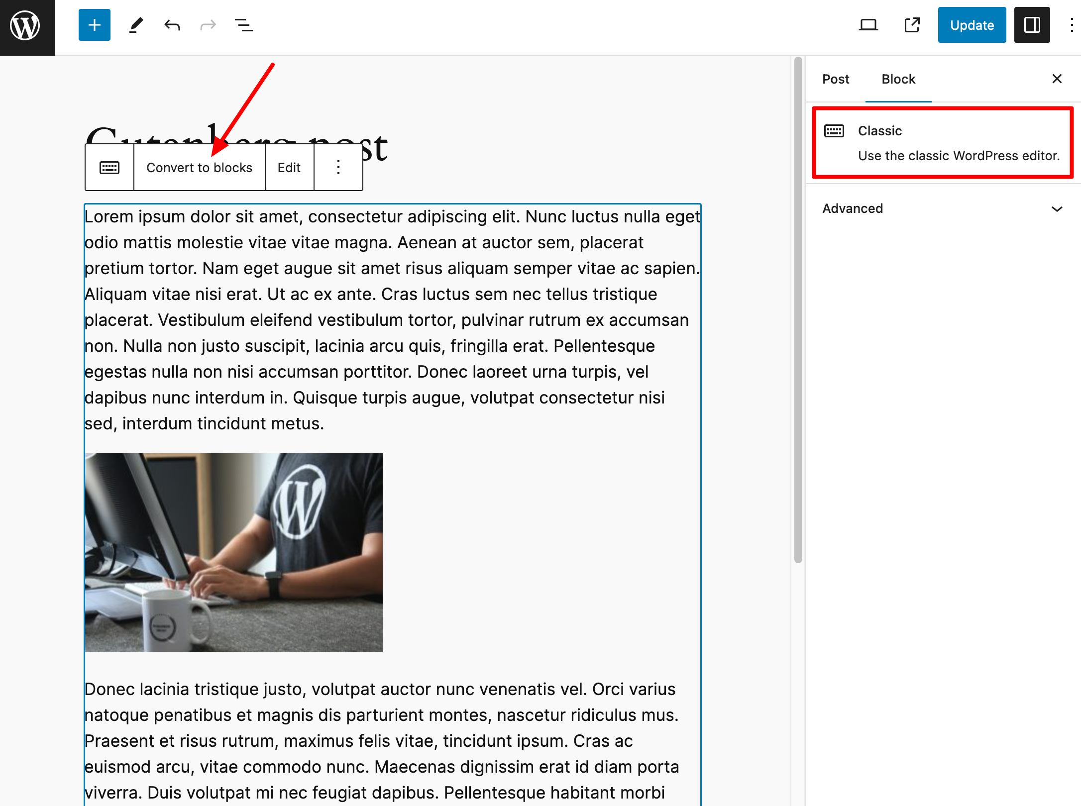 Converting from a classic block to individual blocks.